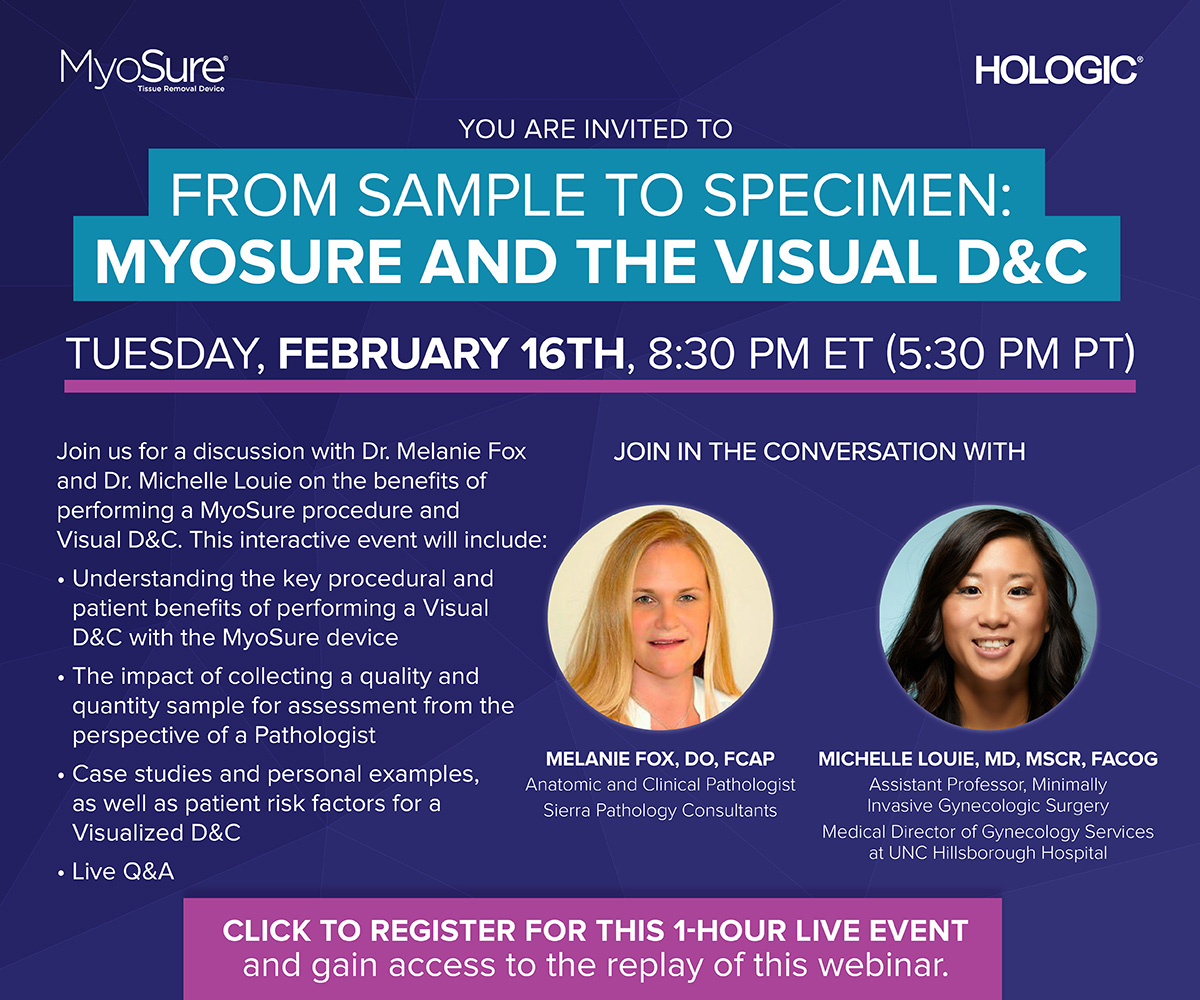 Webinar: From Sample to Specimen - MyoSure and the Visual D&C - Hologic ...